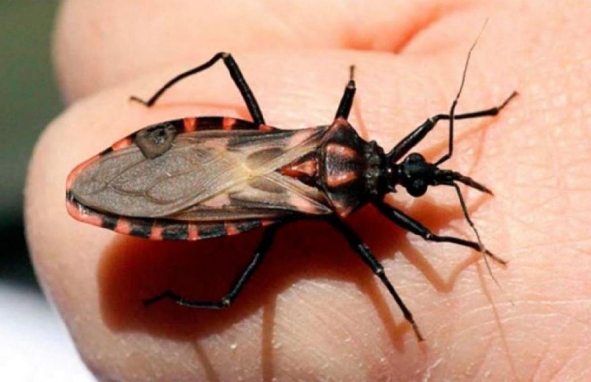 Chagas