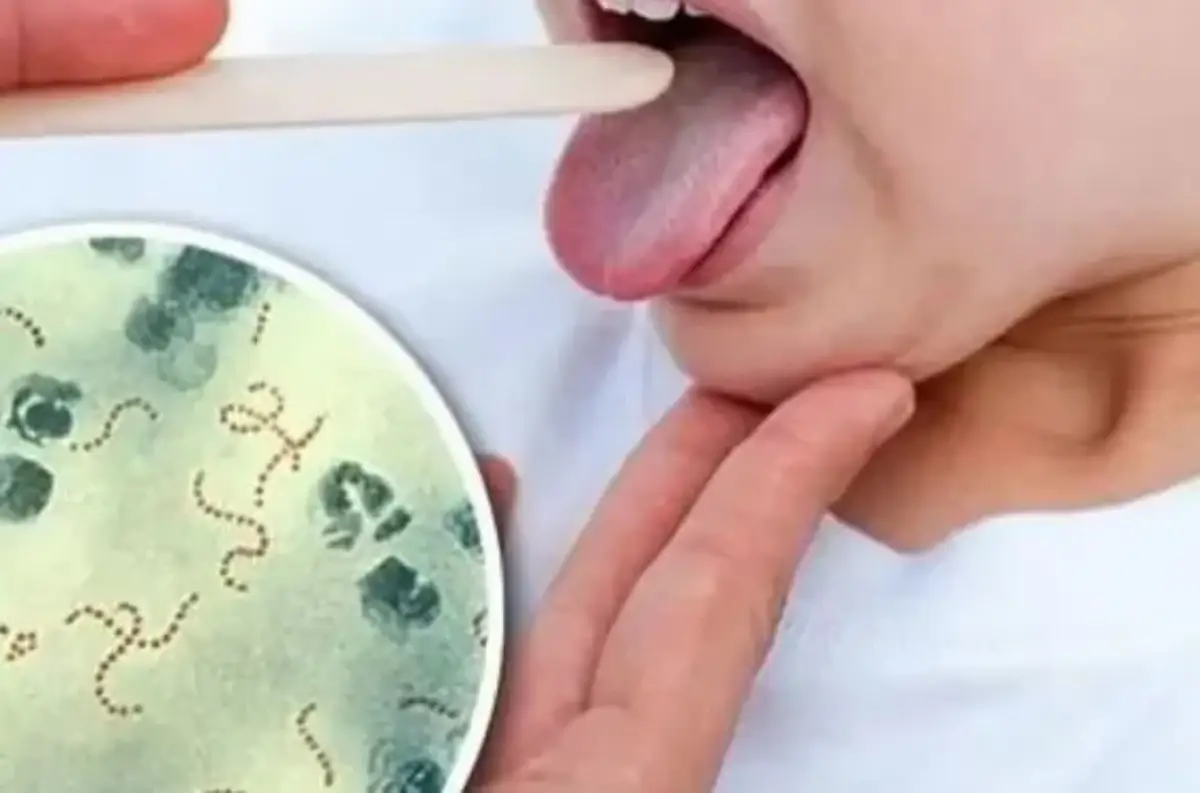 Bacteria