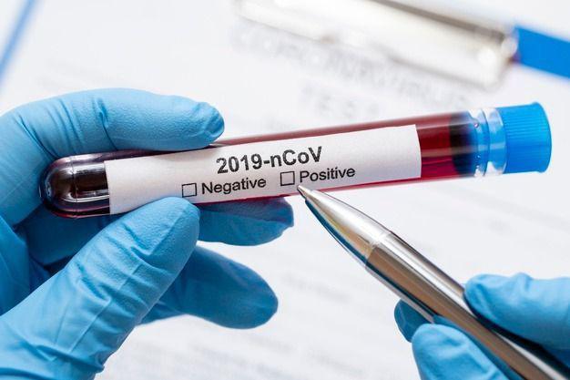 coronavirus