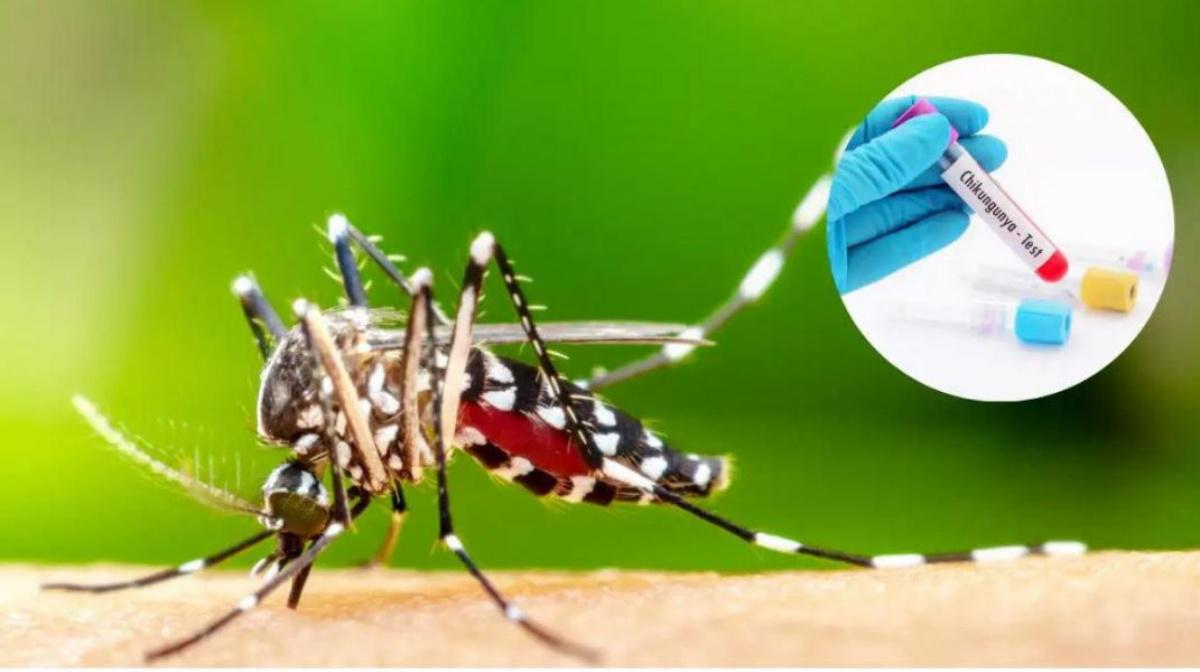 chikungunya